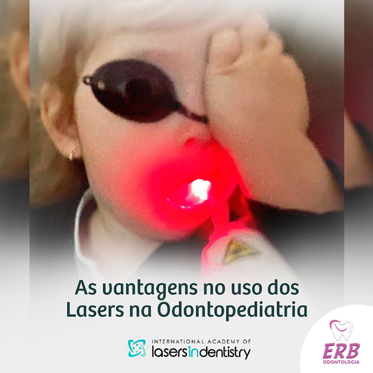 As vantagens no uso dos Lasers na Odontopediatria