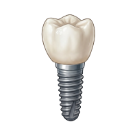 Ilustração detalhada de um conector metálico (abutment) para implante dentário, com encaixe superior octogonal e inferior cônico, sobre fundo rosa claro.